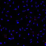 Stained mitochondria under fluorescent microscopy