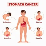 Stomach Cancer Symptoms