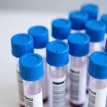 Royal blue blood collection tubes used for lead testing