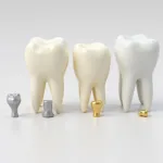 Different Cavity Filling Color Options