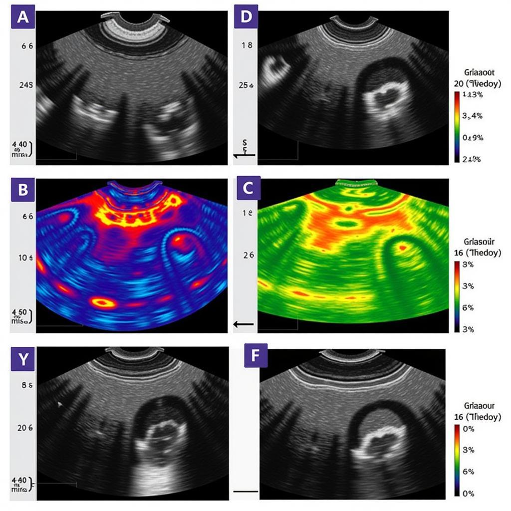 Different Color Representations in Doppler Ultrasound